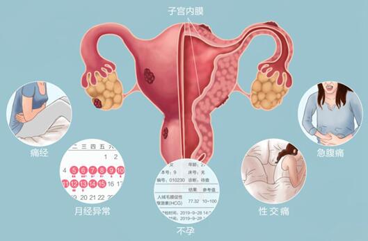 宫腔粘连可以做试管婴儿吗?先治疗再助孕吗？