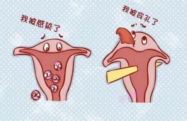子宫穿孔有什么症状？什么原因导致子宫穿孔？