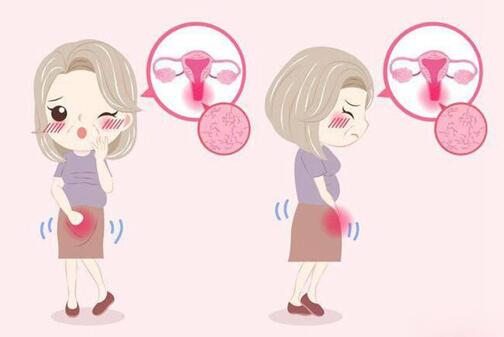 揭秘子宫腺肌症的五大诱发因素,子宫腺肌症应该