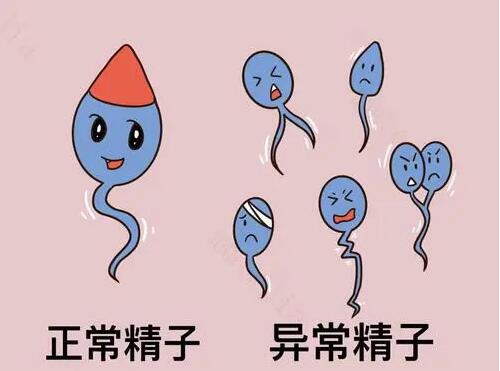 死精症和无精症的区别是什么?揭露两者不同情况